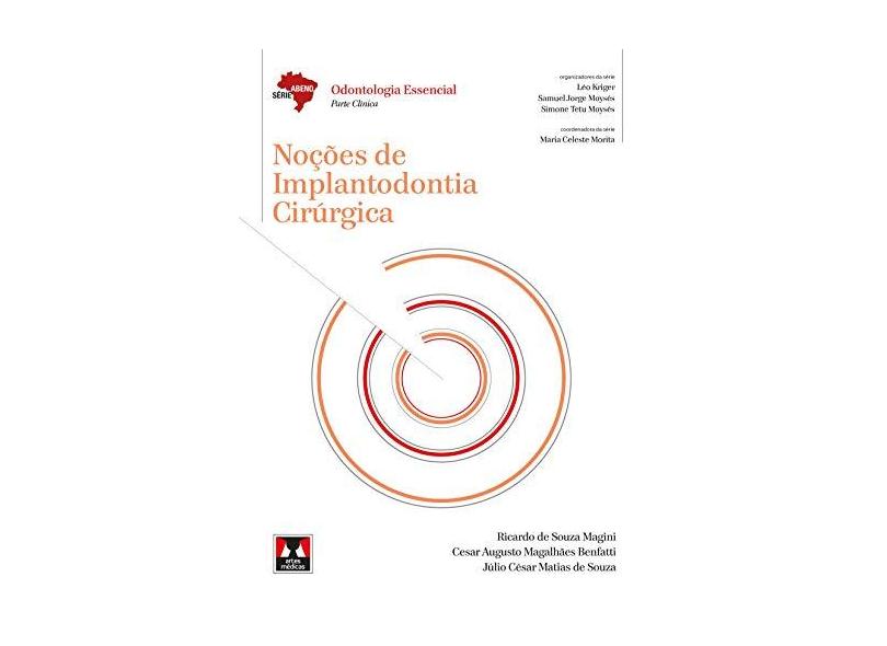 Noções de Implantodontia Cirúrgica - Magini, Ricardo De Souza - 9788536702582