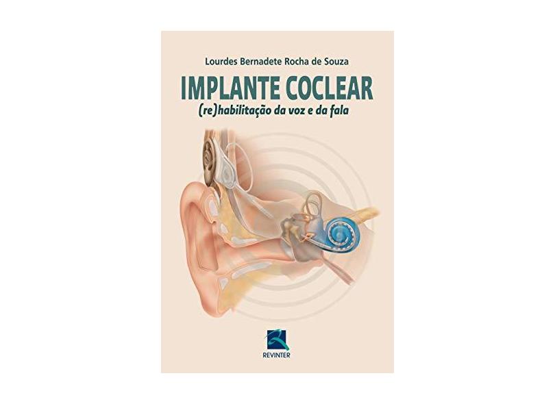 Implante Coclear. Re Habilitação Da Voz E Da Fala - Capa Comum - 9788537204597
