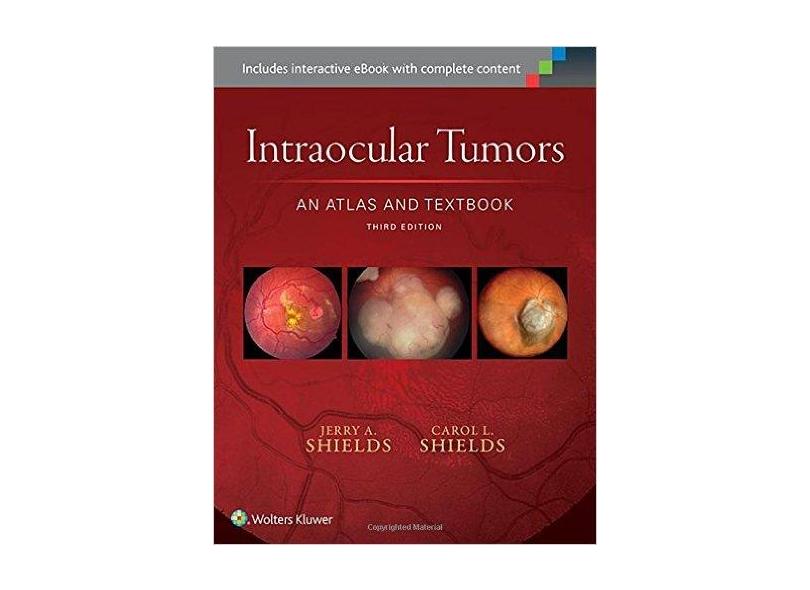 Intraocular Tumors: An Atlas and Textbook - Jerry Shields - 9781496321343
