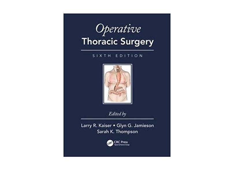 OPERATIVE THORACIC SURGERY - Larry R. Kaiser (editor),    Glyn Jamieson (editor),    Sarah K. Thompson (editor) - 9781482299571
