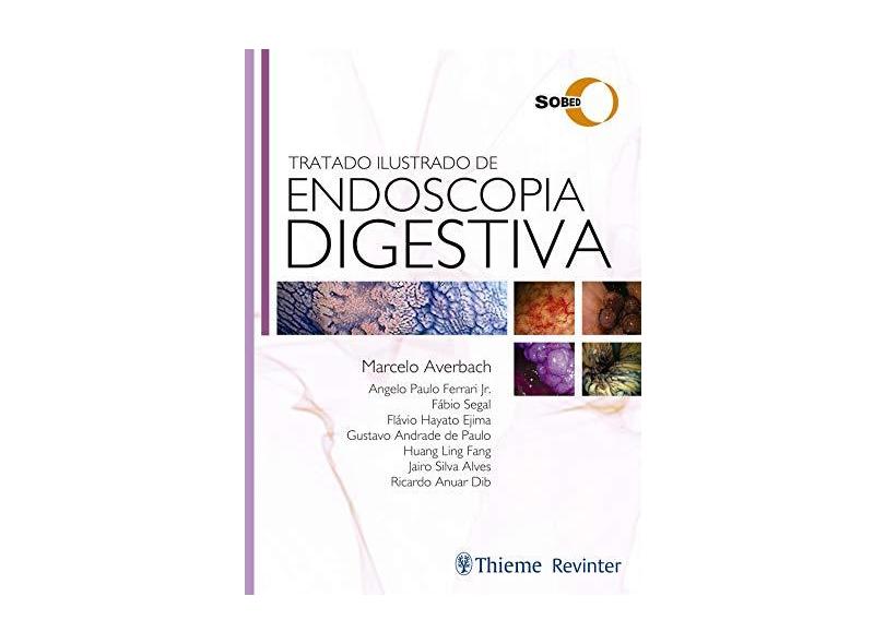 TRATADO ILUSTRADO DE ENDOSCOPIA DIGESTIVA SOBED - Marcelo Averbach - 9788554650070