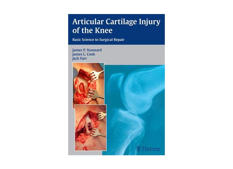 Articular Cartilage Injury of the Knee: Basic Science to Surgical Repair - Capa Dura - 9781604068580