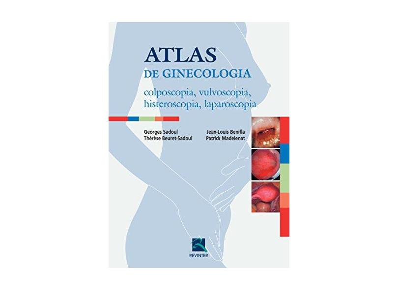 Atlas De Ginecologia. Colposcopia Vulvoscopia Histeroscopia Laparoscopia - Capa Comum - 9788537204665