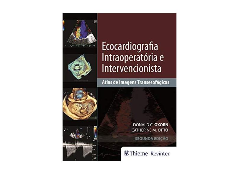 Ecocardiografia Intraoperatória e Intervencionista: Atlas de Imagens Transesofágicas - Donald C. Oxorn - 9788554651022