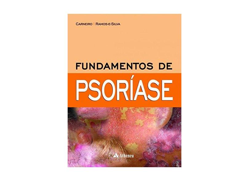 Fundamentos de Psoríase - Sueli Carneiro - 9788538808176