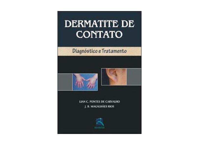 Dermatite De Contato. Diagnostico E Tratamento - Capa Dura - 9788573097900