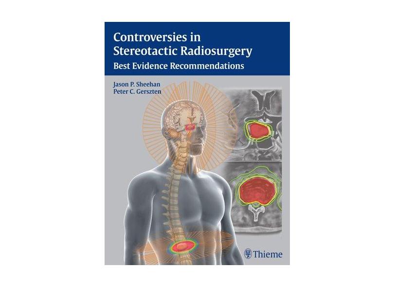 CONTROVERSIES IN STEREOTACTIC RADIOSURGERY: BEST EVIDENCE RECOMMENDATIONS - Jason Sheenan - 9781604068412