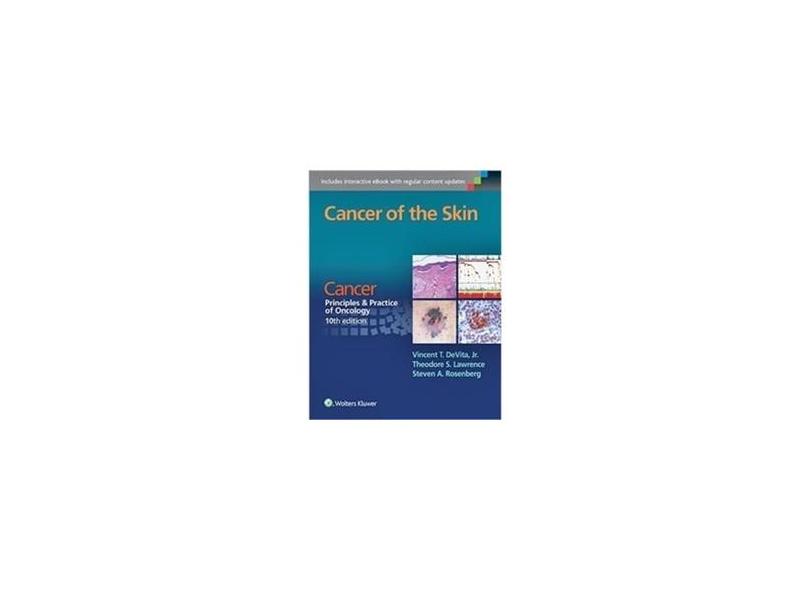 CANCER OF THE SKIN: CANCER: PRINC & PRACTOF ONCOLOGY - Vincent T Devita Jr. Md (author), Theodore S. Lawrence Md Phd (author), Steven A. Rosenberg Md Phd - 9781496333933