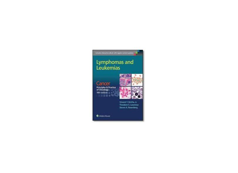 LYMPHOMAS AND LEUKEMIAS: CANCER: PRINC & PRACT OF ONCOLOGY - Devita - 9781496333940