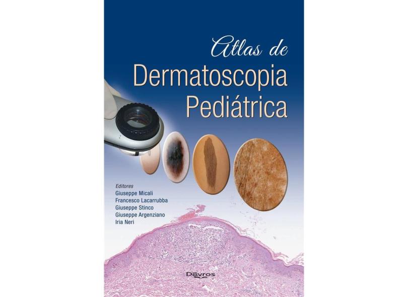ATLAS DE DERMATOSCOPIA PEDIATRICA - Giuseppe Micali Francesco Lacarrubba Giuseppe Stinco Giuseppe Argenziano - 9788580531848