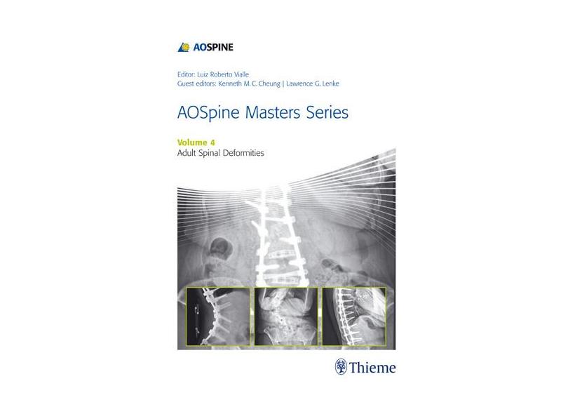 Aospine Masters Series, Volume 4: Adult Spinal Deformities - Luiz Roberto Vialle - 9781626231009