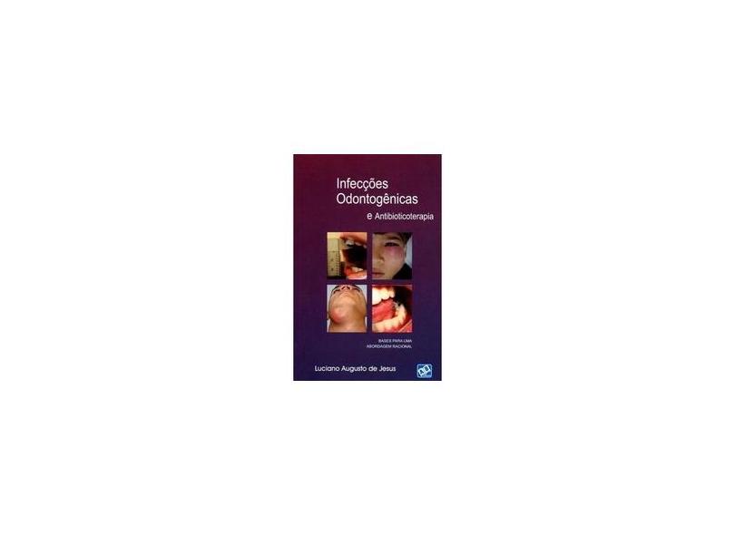 Infecções Odontogênicas e Antibiocoterapia - Bases Para Uma Abordagem Racional - Luciano Augusto De Jesus - 9788574982144