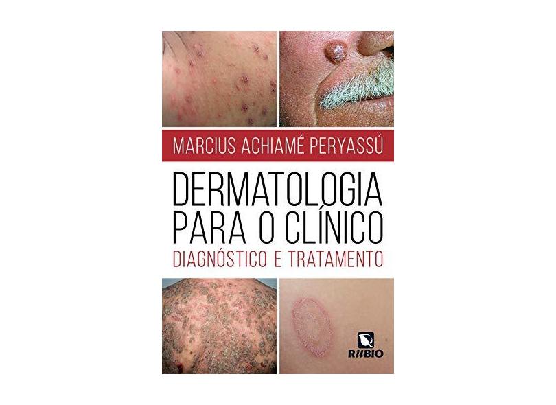Dermatologia Para o Clínico: Diagnóstico e Tratamento - Marcius Achiam&#233; Peryassu - 9788584110223