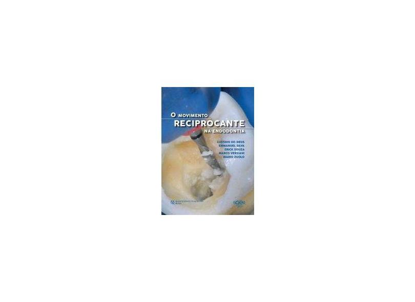 MOVIMENTO, O - RECIPROCANTE NA ENDODONTIA - De- Deus , Gustavo / Silva, Emmanuel  / Souza, Erick  / Versiani, Marco  / Zuolo, Mario - 9788578891084