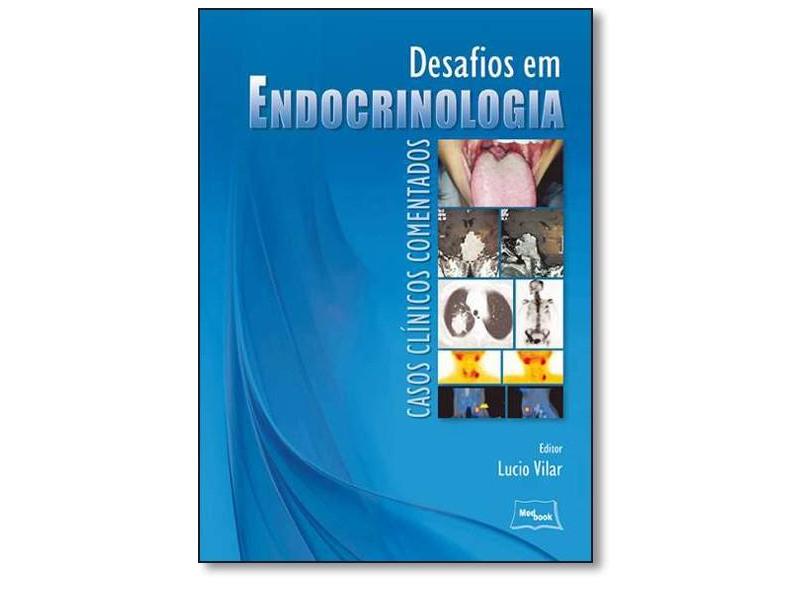 Desafios em Endocrinologia: Casos Clínicos Comentados - Lucio Vilar - 9788583690054