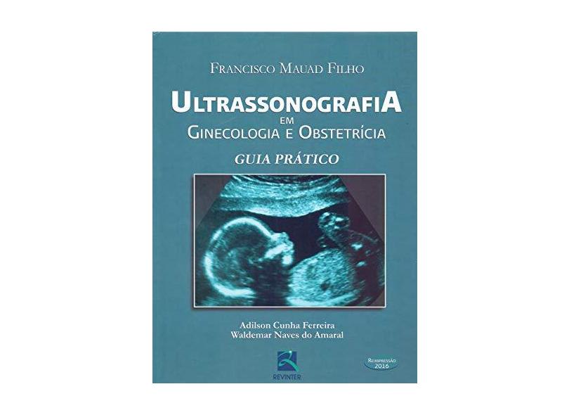 Ultrasonografia Em Ginecologia E Obstetricia. Guia Prático - Capa Comum - 9788537203101