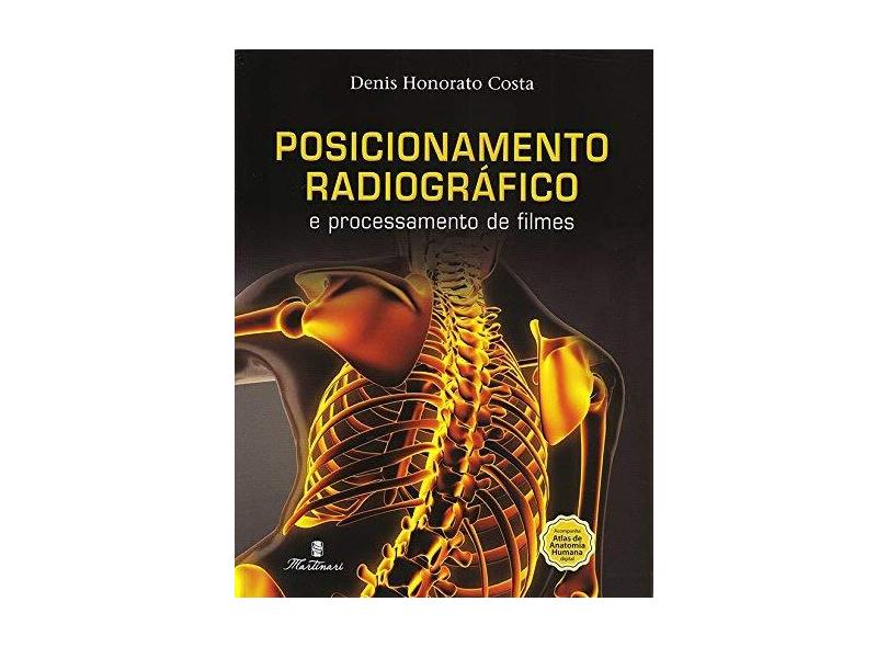 Posicionamento Radiográfico e Processamento de Filmes - Denis Honorato Costa - 9788581160771