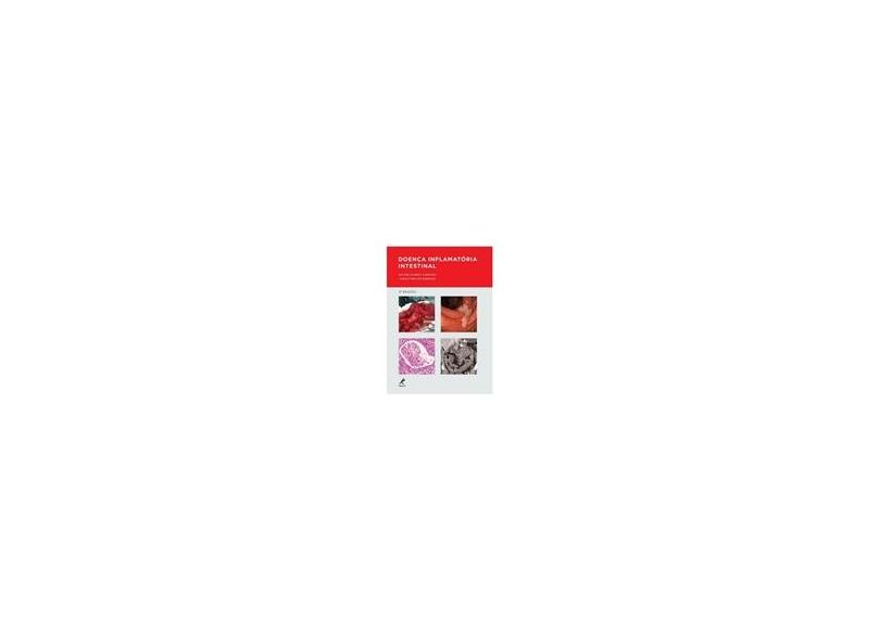 Doença Inflamatória Intestinal - 2ª Ed. 2015 - Cardozo, Wilton Schmidt; Sobrado, Carlos Walter - 9788578681913
