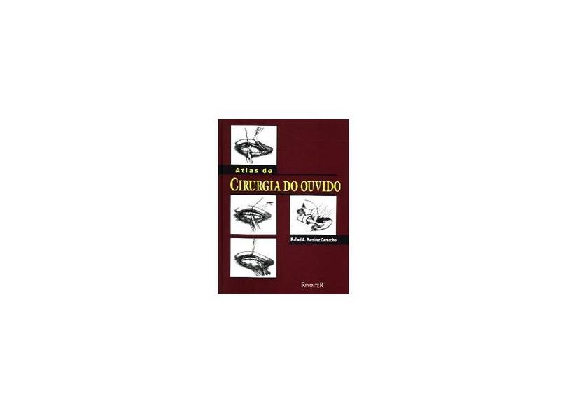 Atlas De Cirurgia Do Ouvido - Capa Comum - 9788573092707