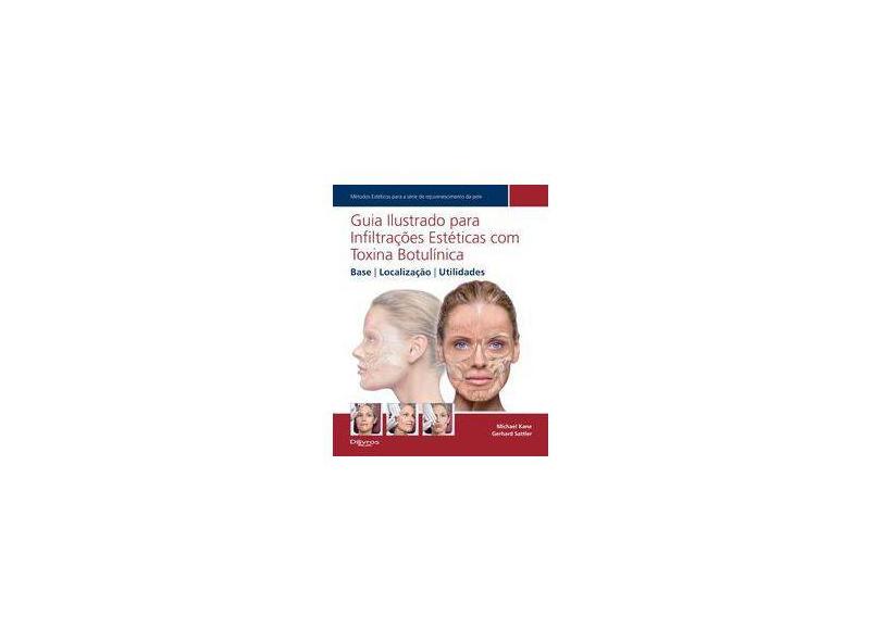 GUIA ILUSTRADO PARA INFILTRACOES ESTETICAS COM TOXINA BOTULINICA - Kane, Michael / Satler, Gehard - 9788580531053