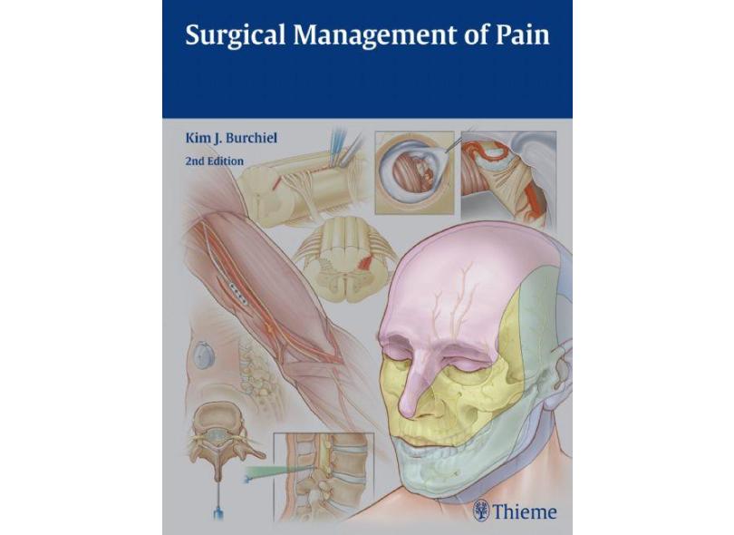 Surgical Management Of Pain - "burchiel, Kim J." - 9781604067514
