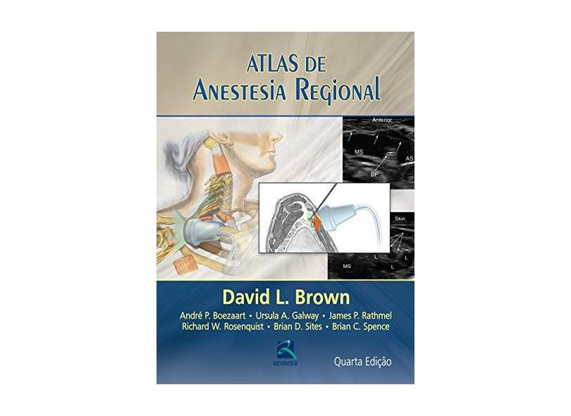 Atlas De Anestesia Regional - Capa Comum - 9788537204894