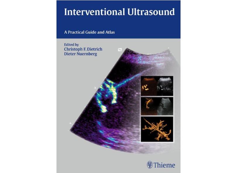 Interventional Ultrasound: A Practical Guide and Atlas - Christoph Frank Dietrich - 9783131708212