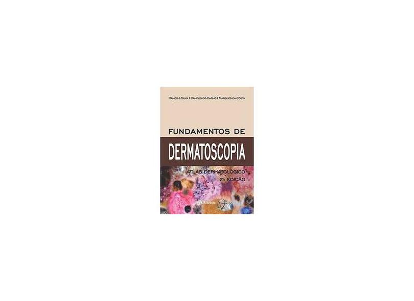 Fundamentos de Dermatoscopia: Atlas Dermatologico - Ramos E Silva - 9788538805977