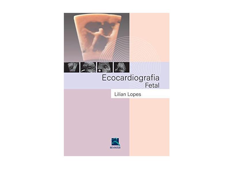 Ecocardiografia Fetal - Lilian Lopes - 9788537206423