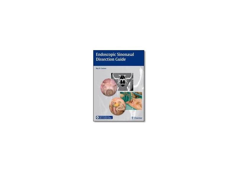ENDOSCOPIC SINONASAL DISSECTION GUIDE - Roy Casiano - 9781604065879