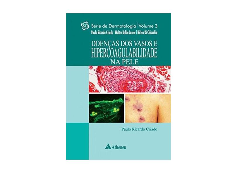 Doenças dos Vasos e Hipercoagulabilidade na Pele - Vol.3 - Série Dermatologia - Paulo Ricardo Criado - 9788538807254