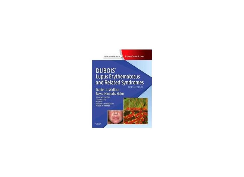 DuBois' Lupus Erythematosus and Related Syndromes: Expert Consult - Online and Print - Daniel Wallace - 9781437718935