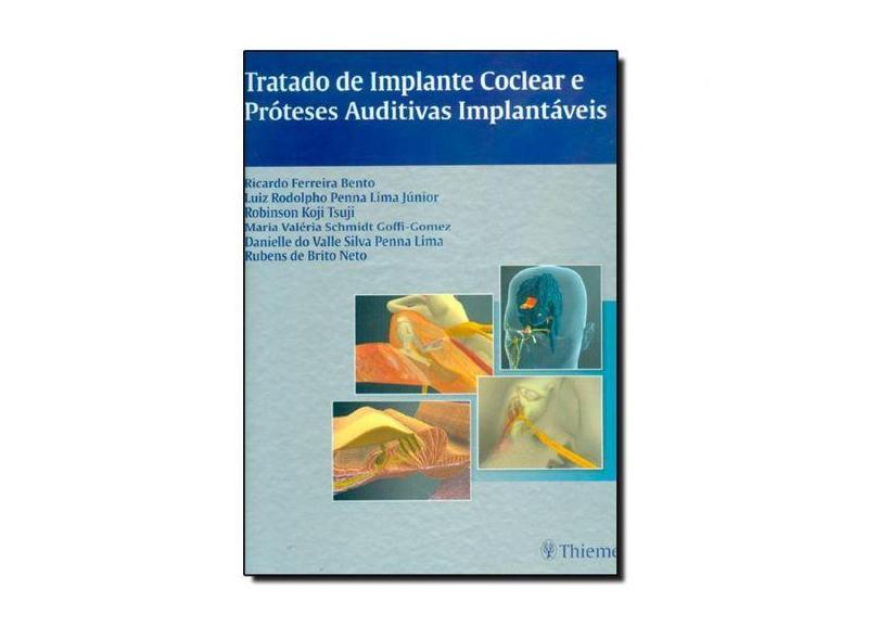 Tratado De Implante Coclear E Proteses Auditivas Implantaveis - Ricardo Ferreira Bento - 9788567661025