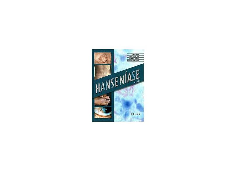 Hanseníase - Varios Autores - 9788580530865