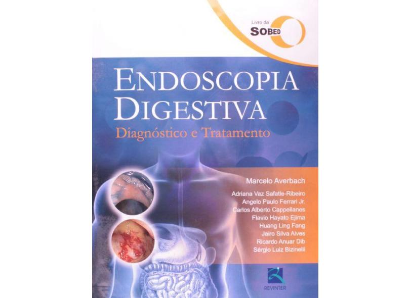 Endoscopia Digestiva Diagnostico E Tratamento - Capa Dura - 9788537205112
