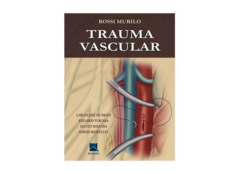 Trauma Vascular - Murilo, Rossi - 9788573099751