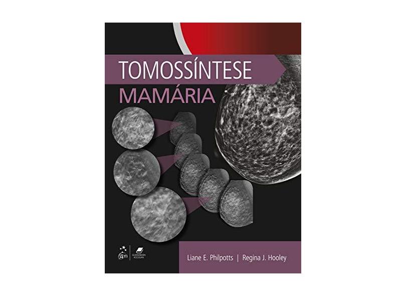 Tomossíntese Mamária - Liane Philpotts - 9788535284515