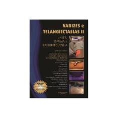 Imagem de VARIZES E TELANGIECTASIAS II - Merlo, Ivanesio/bastos,francisco Reis/parente,jose Bem-hur /julio Henrique G. Ferreira/murilo,rossi - 9788580530698