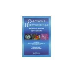 Imagem de Carcinoma Hepatocelular Dos Fatores De Risco Ao Tratamento - William Abrão Saad, Eliazar Chaib, Marcelo Augusto Fontenelle Ribeira Júnior - 9788573797039
