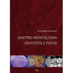 Imagem de Gastro-Hepatologia Em Fotos e Fatos - Mendes, Guilherme Santiago - 9788588361805