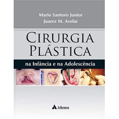 Imagem de CIRURGIA PLASTICA NA INFANCIA E NA ADOLESCENCIA - Mario Santoro Junior - 9788538808770