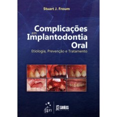 Imagem de Complicações do Implante Dental - Etiologia, Prevenção e Tratamento - Froum, Stuart J. - 9788541201421