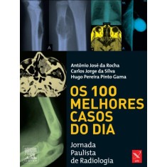 Imagem de Os 100 Melhores Casos do Dia - 1ª Ed. - José Da Rocha, Antonio - 9788535238792