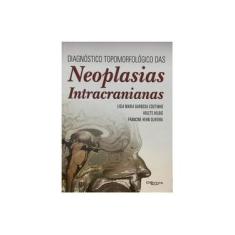 Imagem de NEOPLASIAS INTRACRANIANAS - Coutinho, Ligia Maria Barbosa / Hilbig, Arlet / Oliveira, Francine Hehn - 9788580531480