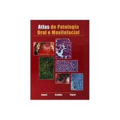 Imagem de Atlas De Patologia Oral E Maxilofacial - Capa Comum - 9788527706841