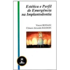 Imagem de Estética e Perfil de Emergência na Implantodontia - Bennani, Vicent; Baudoin, Clément-alexandre - 9788573079470