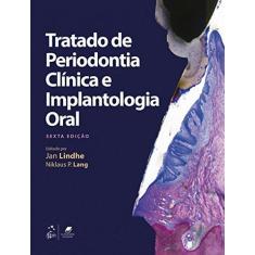 Imagem de Tratado De Periodontia Clínica E Implantologia Oral - Lang,niklaus P. - 9788527732901