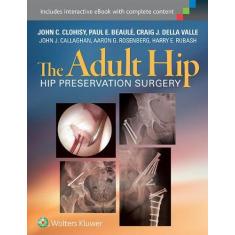 Imagem de THE ADULT HIP : HIP PRESERVATION SURGERY - John Clohisy ,  Paul Beaule  ,  Craig Dellavalle - 9781451183931