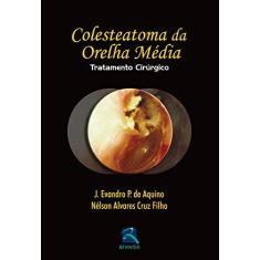 Imagem de COLESTEATOMA DA ORELHA MEDIA - TRATAMENTO CIRURGICO - Aquino, J. Evandro P. De / Cruz Filho, Nelson Alvares - 9788537205525