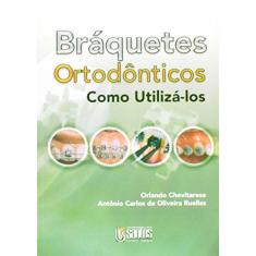 Imagem de Bráquetes Ortodônticos - Como Utilizá-los - Chevitarese, O. - 9788572885058